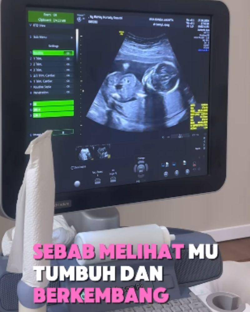 Instagram.com/@kikysaputrii